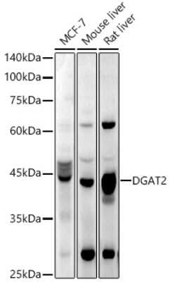 Western Blot: DGAT2 AntibodyAzide and BSA Free [NBP2-92727]